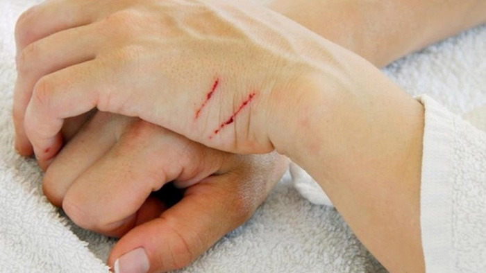 TP.HCM: Cảnh báo bệnh dại trở lại
